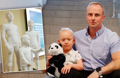 Specjalistyczna odzież medyczna dla dzieci z ichtiozą. Przełom w codziennej opiece