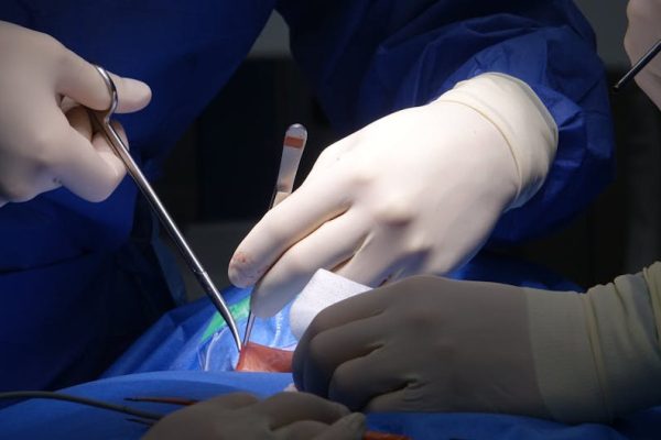Prof. Rękas ostrzega: ograniczenie finansowania operacji zaćmy wydłuży kolejki pacjentów