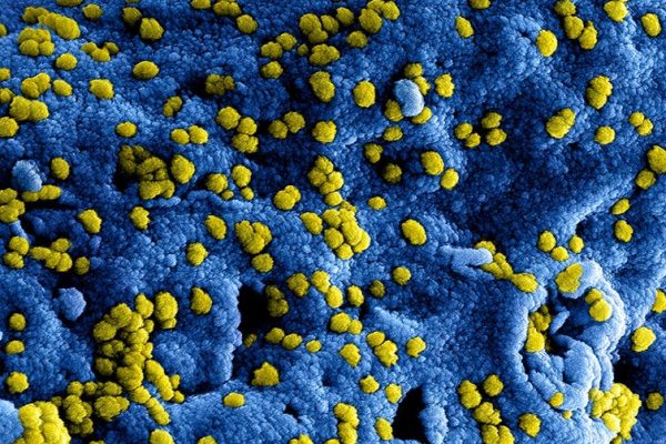 GIS uspokaja: Ebola w Polsce mało prawdopodobna, ale służby są w gotowości
