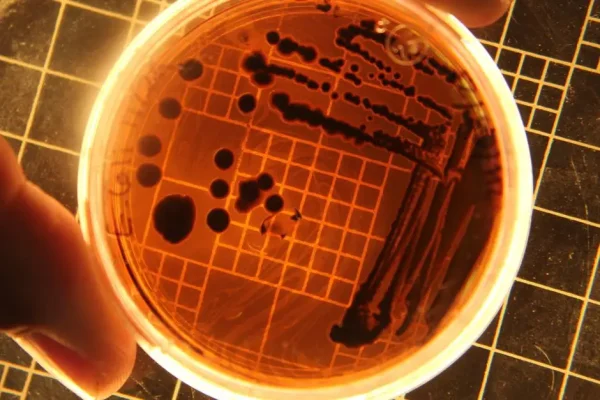 Salmonella w suplemencie Verdin Fix – GIS ostrzega przed dwiema partiami