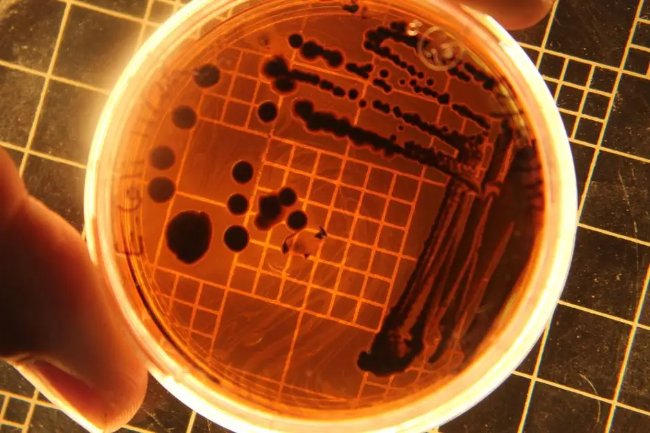 Salmonella w suplemencie Verdin Fix – GIS ostrzega przed dwiema partiami